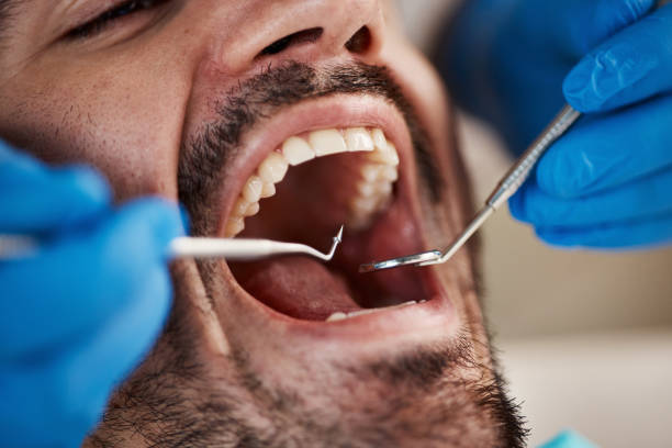 Best Emergency Tooth Extraction in Woodbine, NJ